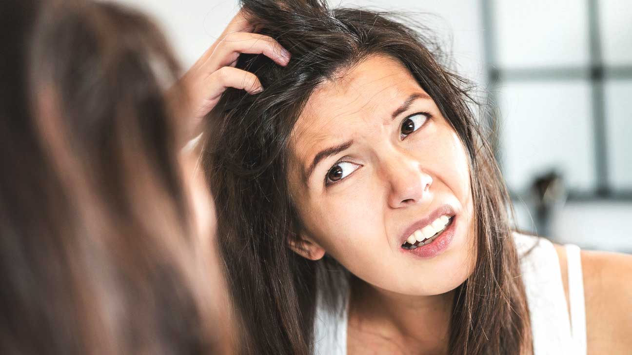How to Get Rid of Dandruff Fast or Quickly