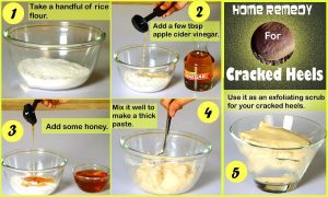 Rice Flour, Honey, And Cider Vinegar For Cracked Heels
